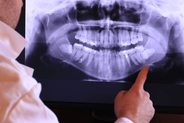 Best Emergency Tooth Extraction in Crane, TX