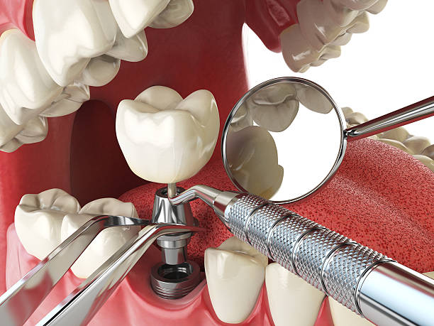 Best Emergency Gum Treatment in Crane, TX